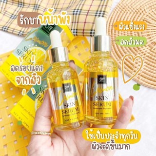 CHY HOYONNA LEMON SKIN SERUM ซีเอชวาย เซรั่ม 30 ml. LEMON PEEL BIOFERMENT