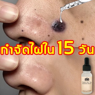 อัพเกรดสูตรใหม่ ครีมกําจัดไฝจีจี้ 20ml ลบไฝ จุดด่างดำ ฝ้ากระ ไฝออกอย่างรวดเร็วโดยไม่ทิ้งรอย กำจัดไฝ ครีมกำจัดไฝ ครีมทาไฝ