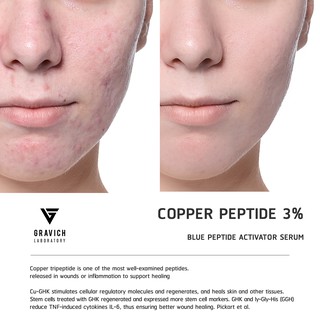 gravich blue peptide