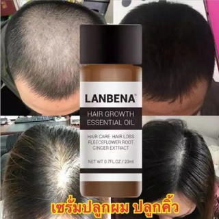 LANBENA น้ำยาปลูกผม ป้องกันหัวล้าน ป้องกันผมร่วง รักษาผมร่วง เร่งผมงอกใหม่ บำรุงผม ฟื้นฟูผมแห้งเสีย แก้ปัญหาผมร่วง-0380