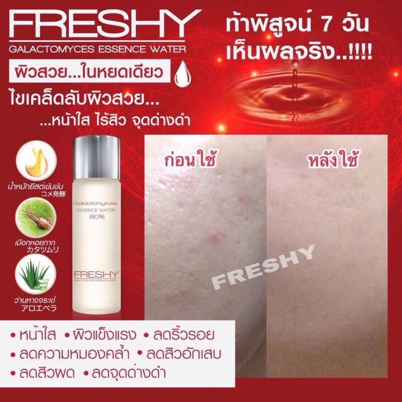 น้ำตบ Freshy Galactomyces Essence Water 80%