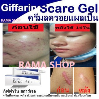 🔥ส่งฟรี🔥 เจลเมือกหอยทาก ลดลอยแผลเป็น รอยแดง รอยดำ จากสิว หลุมสิว รอยนูน Giffarine Scar Gel (สกาเจล)