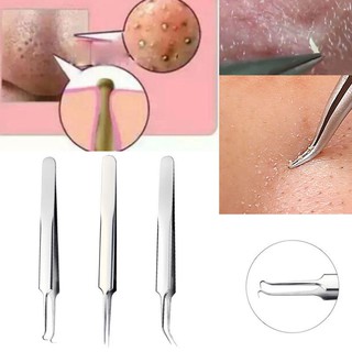 💎♥ Bend Curved สิวหัวดำสิว Comedone Pimple Extractor Remover แหนบ