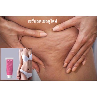 เซรั่มลดเซลลูไลท์ แก้ไขผิวเปลือกส้มZHZ body