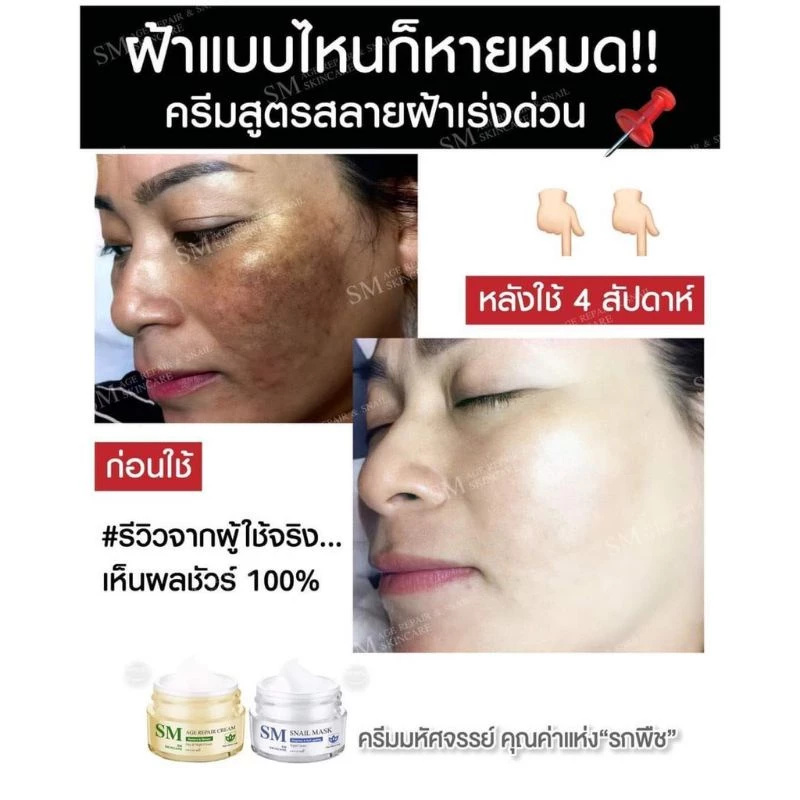 ✅ [ส่งฟรี+ส่วนลด] เซตครีมรกพืชเอสเอ็ม SM 15 g. #SM Skincare#เอสเอ็ม สกินแคร์ thumbnail 6