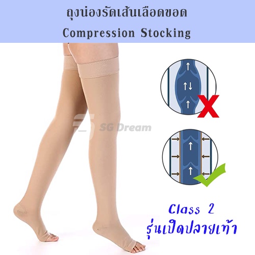 ถุงน่องรัดเส้นเลือดขอด ถุงน่องป้องกันเส้นเลือดขอด ถุงน่องรัดขา เฉพาะขา รุ่นเปิดปลายเท้า Class 2 (23-32 mmHg) / Open Toe