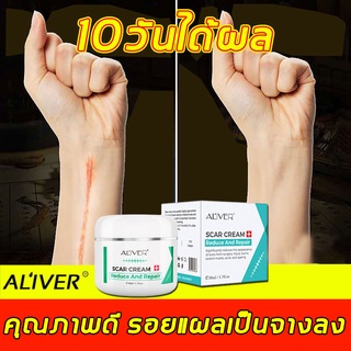 【ลดกระหน่ำ】ALIVER ครีมลดรอยแผลเป็น 50ml ซ่อมแซมแผลไฟ （ครีมลดรอยแผลเป็น เจลลดรอยแผลเป็น ครีมลบรอยแผลเป็น ）Scar cream