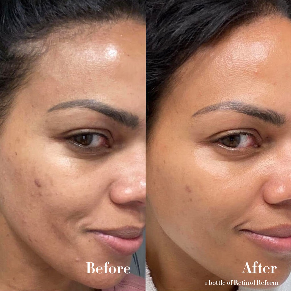 shani darden retinol