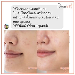 [Promotion ซื้อ 1แถม1] Dearest 2in1 mask&clean เจลล้างหน้าสูตรเซรั่ม 100 ml.