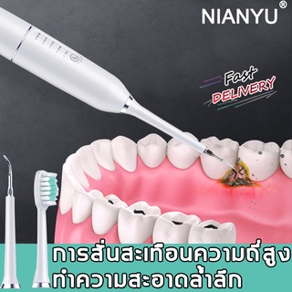 NIANYUเครื่องขูดหินปูนไฟฟ้า ทำความสะอาดฟันเหลืองและดำได้อย่างง่าย คราบฟัน แคลคูลัส เครื่องขัดฟัน เครื่องขัดหินปูน