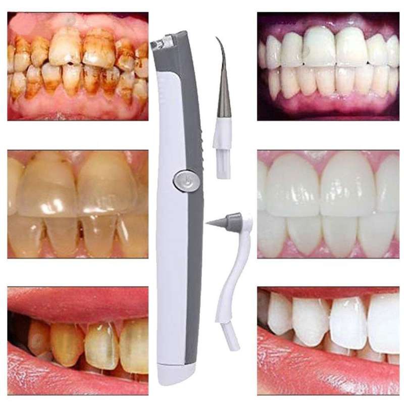 เครื่องล้างฟันอัลตราโซนิกไฟฟ้า เครื่องล้างฟัน ทำความสะอาดฟัน ทำทันตกรรมทำความสะอาดฟัน เครื่องมือดูแลฟัน ฟันขาว กำจัดคราบ - รูปที่ 3