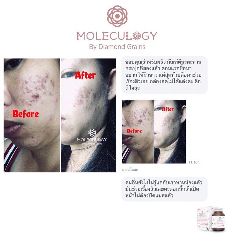 ถูกสุด🔥กลาสซี่ เอ็กซ์ Glassy X Moleculogy glassyx molegulogy กลาสซี่เอ็ก glassy x 1 กระปุก