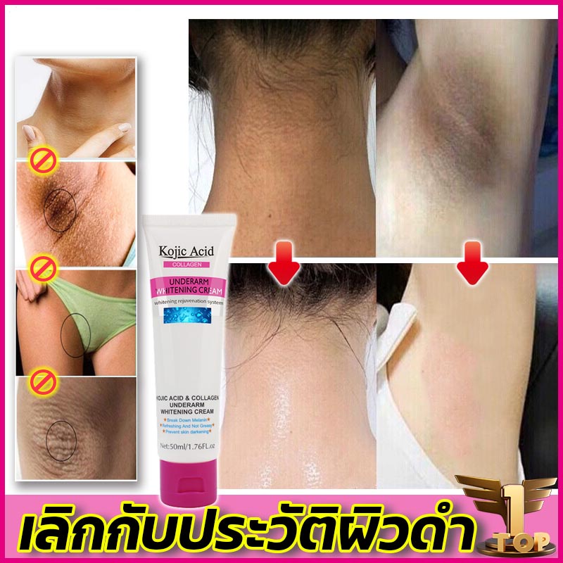 Kojic Acid 50ml ครีมทาใต้วงแขน ครีมขจัดขาหนีบดำ คอดำ รักแร้ดำ ก้นดำ ใช้ทาได้ทั้งตัว