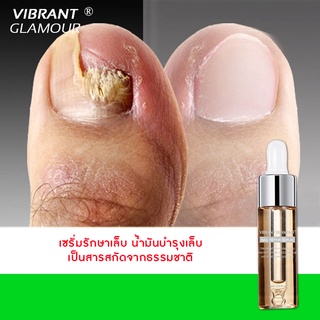 VIBRANT GLAMOUR เซรั่มรักษาเล็บ น้ำมันบำรุงเล็บ กำจัดเชื้อราที่เล็บ รักษาเล็บเปราะ เล็บอ่อนแอ บำรุงอย่างล้ำลึก