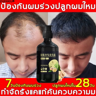 ZHENXIU แชมพูขิง 300ml แชมพูแก้ผมร่วง สำหรับผมบาง ขิงช่วยป้องกันผมร่วง แชมพูสำหรับ ผมขาดหลุดร่วงขิงบำรุงถึงราก แชมพูขจัด