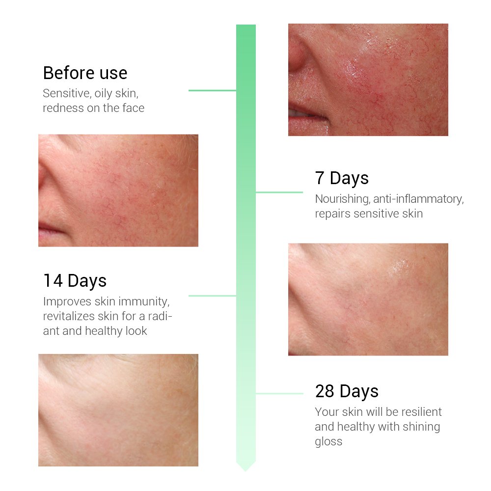 face care for redness