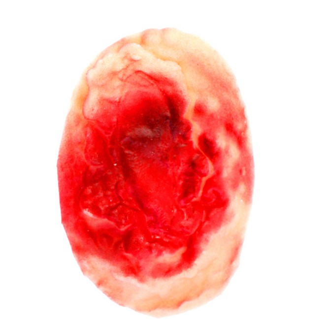 แผลตะปู  แผล สติ๊กเกอร์ สติ๊กเกอร์แผล แผล แผลปลอม ของเล่นเด็ก พร้อมส่ง - รูปที่ 3