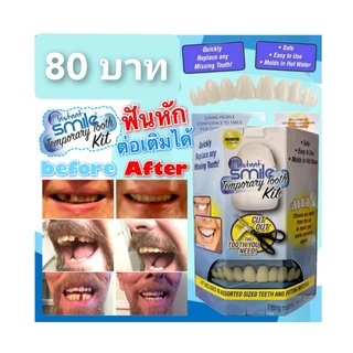 instant smile temporary tooth kit ฟันปลอมเสริมบุคลิค