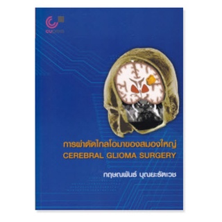 chulabook 9789740340959 การผ่าตัดไกลโอมาของสมองใหญ่ (CEREBRAL GLIOMA SURGERY)