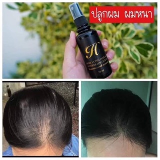 #HISO LONG HAIR &amp; ANTI HAIR LOSS SERLM ปริมาณ 50 ML. (สเปย์เซรั่มปลูกผม ลดร่วง ลดบาง ชะลอหงอก คัน รังแค บำรุงรากผมดี