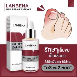 Lanbena_ยา_เซรั่ม_รักษาเล็บขบ_เชื้อรา_หายขาด_แถมตะไบ