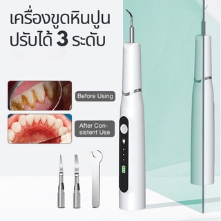 เครื่องขูดหินปูนไฟฟ้า เครื่องทำความสะอาดฟัน ที่ขูดหินปูน ปรับได้ 3 ระดับ กันน้ำ ขจัดแบคทีเรียคราบพลัค alizwellmart