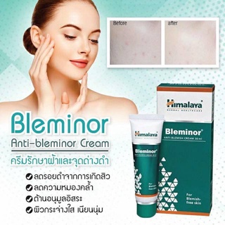 ครีมรักษาฝ้ากะและจุดด่างดำ รอยแกะสิว Himalaya Bleminor 30 ml