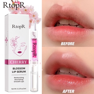 ราคาRtopR FDA ดอกซากุระ ปากอมชมพู ลิปเซรั่ม เมลาโทนิน บำรุงริมฝีปาก ให้ความชุ่มชื้น ติดทนนาน Lip Lightening Serum