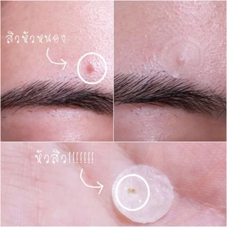 Duo dermaAngel Day 24 ชิ้น + dermaAngel Night 12 ชิ้น 1 กล่อง (D24&N12)