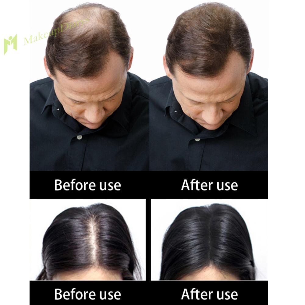 Hair Building Fibers Hair Loss Treatment Care Conceal Thinning