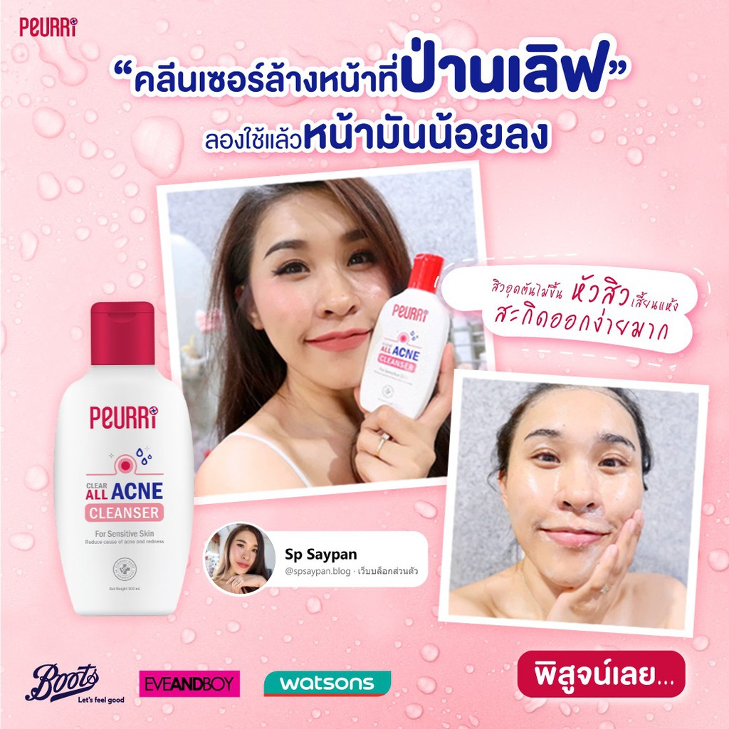 Puricas SET ล้างสิวหลุด ดูดหัวสิว ลดรอยดำ-แดง — صورة 4