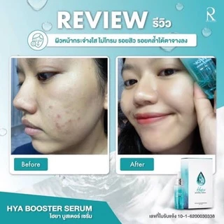 Ratcha Hya Booster Serum รัชชา ไฮยาน้องฉัตร บูสเตอร์ เซรั่ม 15 ml. ของแท้100%