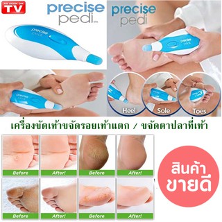 Precise Pedi เครื่องขัดเท้าขจัดรอยเท้าแตก / ขจัดตาปลาที่เท้า ขัดทำความสะอาดได้ทุกซอกมุมของเท้า