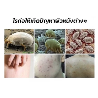Zudaifu เจลอาบน้ำสมุนไพร สูตรโกฐจุฬาลัมพา อ่อนโยน ครีมอาบน้ำ กำจัดไร แก้ขนคุด เรื้อรัง ลดอาการคันผิวหนัง ลดไรและสิวหล้ง