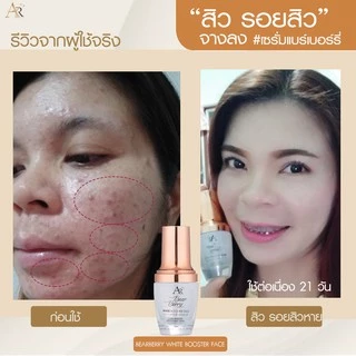 เซรั่มจ๊ะ Aura Rich Bearberry White Booster Face