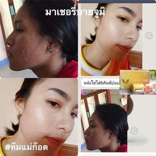 มาเชอรี่ บาย จูมิ Whitening Cream Set(สีทอง)