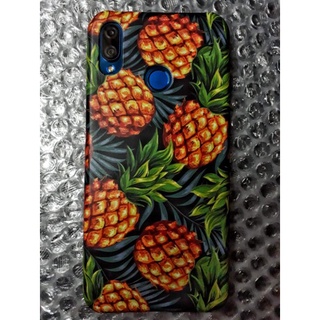 เคสแข็งลายสับปะรด Xiaomi Redmi Poco (เคสไม่คลุมรอบนะคะ เปิดบน เปิดล่าง)