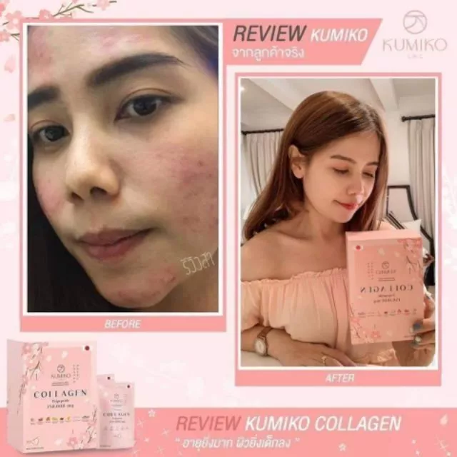 Kumiko Collagen คอลลาเจนพรีเมี่ยมจากญี่ปุ่น thumbnail 7