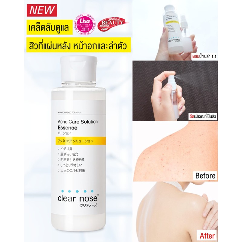 clear nose acne care solution essence