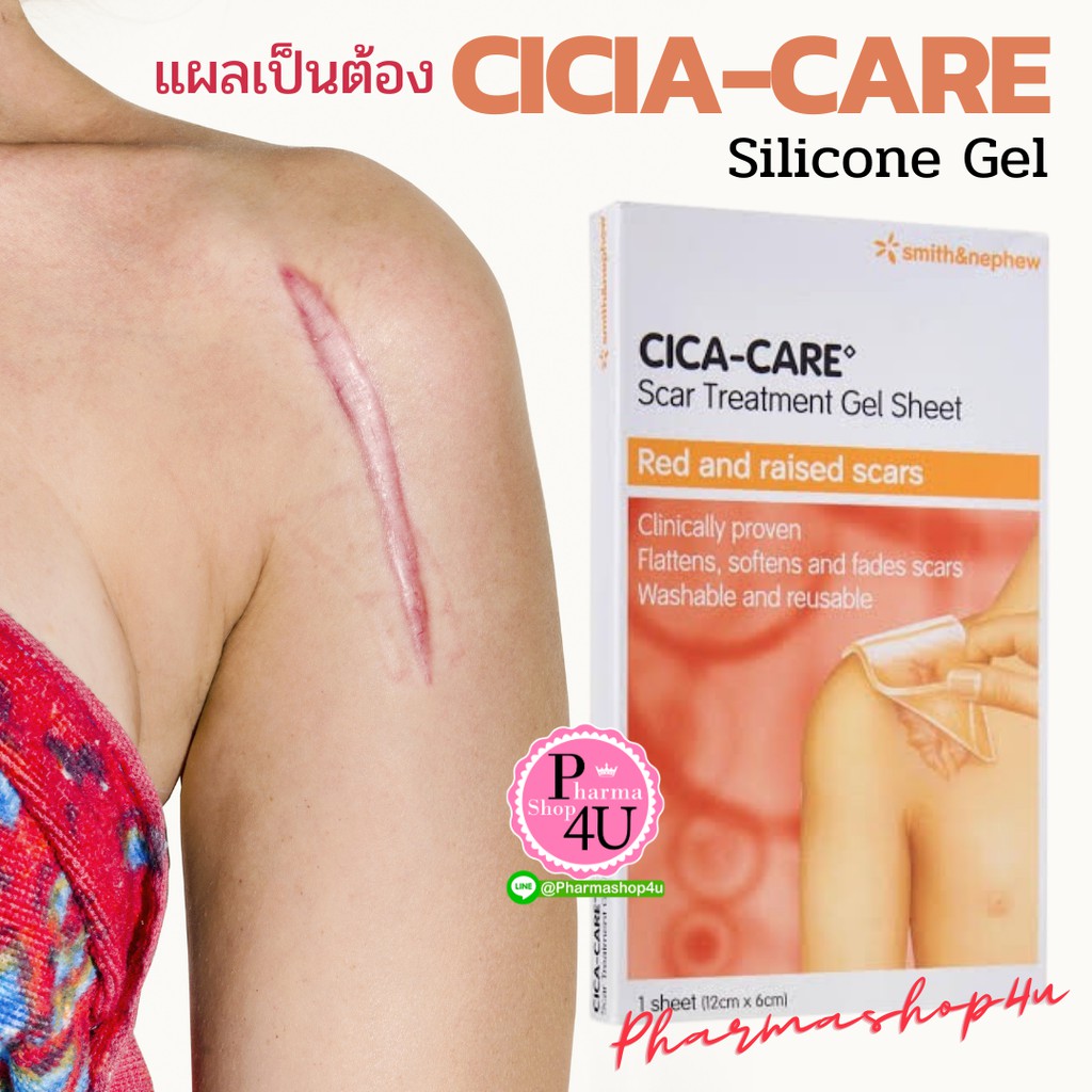 แผ่นซิลิโคน เจลชีท CICA-CARE ลดรอยแผลเป็น cica care / SILICONE GEL 15G