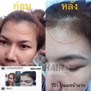 ของแท้!!! Real Hair- เซรั่มปลูกผม คิ้ว หนวด จอน -(สูตรหัวเชื้อ) ใช้ได้ทั้ง ช ญ