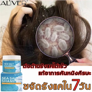 ขจัดรังแคใน7วัน！ALIVERเกลือทะเล แชมพูขจัดรังแค 240mlยาสระผมรังแค แชมพูรักษารังแค แชมพูแก้ผมร่วง ยาสระผมเชื้อรา