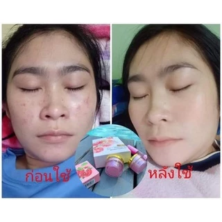 ครีมสโนไวท์ของแท้100%1ชุดประกอบด้วย4ชิ้น💐(เซรั่ม,ครีมกลางวัน,ครีมกลางคืน,สบู่)
