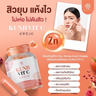 ของแท้ !!! กันต์จิวิตซี (Kunji VitC) ผิวขาวออร่า ลดสิวผิวใส