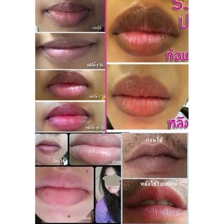 ครีมแก้ปากดำ ลิป Lip Treatment ชมพูแบบธรรมชาติ เหมาะกับทุกสภาพผิว เดอร์ม่า พรรณ DERMA PAN หลอดเขียว ทาก่อนนอน