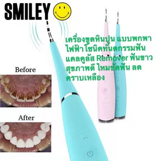 Electric Dental Scaler Tooth  เครื่องขูดฟันไฟฟ้า เครื่องขูดหินปูนไฟฟ้า ที่ขูดหินปูน