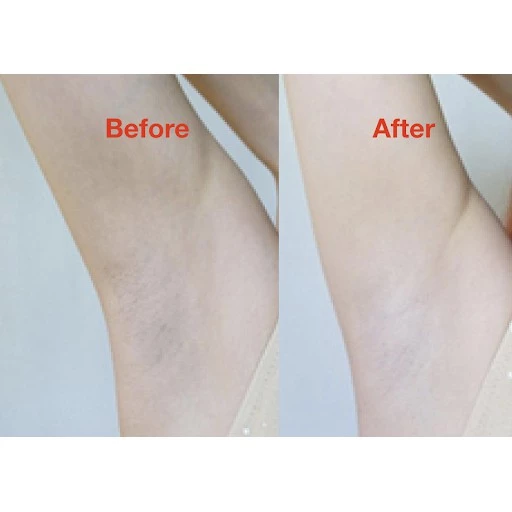 AR โรลออนวิตามินอี ระงับกลิ่นกาย ลดหมองคล้ำ มี2สูตร 75ml. thumbnail 6