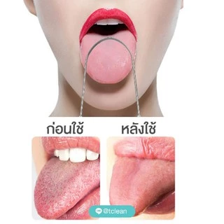 [ส่งด่วน + Travel case] ที่ขูดลิ้น สแตนเลส T-clean Tongue scraper ที่แปรงลิ้น ลดกลิ่นปาก ลดแบคทีเรียในช่องปาก