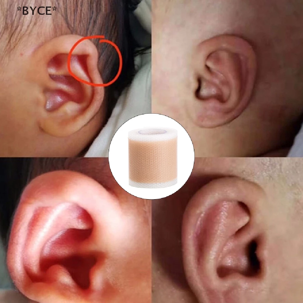 Byce> แผ่นแปะหู เทปซิลิโคน แก้ไขหู สําหรับเด็กทารก