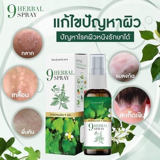 ส่งฟรี ✅ สเปรย์แก้คัน  โปร 6แถม1 สเปรย์รักษาสังคัง กลากเกลื้อน สะเก็ดเงิน เชื้อรา อาการคันต่างๆ เชื้อราหนังศรีษะ